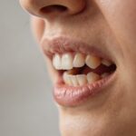 Bruxismus, reflux a dýchání ústy: proč vlastně skřípeme zuby?