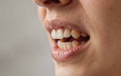Bruxismus, reflux a dýchání ústy: proč vlastně skřípeme zuby?